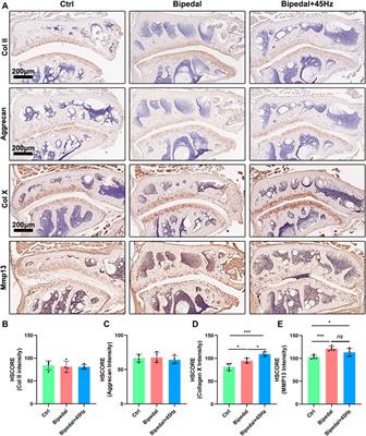 Long-term whole-body vibration induces degeneration of intervertebral disc and facet joint in a <mark class="highlighted">bipedal</mark> mouse model